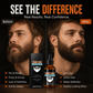 🔄🧔‍♀️🧔‍♂️ LIMITED-TIME 50% OFF!🎉Nourishing Beard Care Essential Oil 